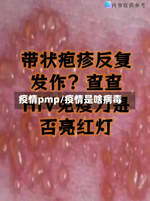 疫情pmp/疫情是啥病毒