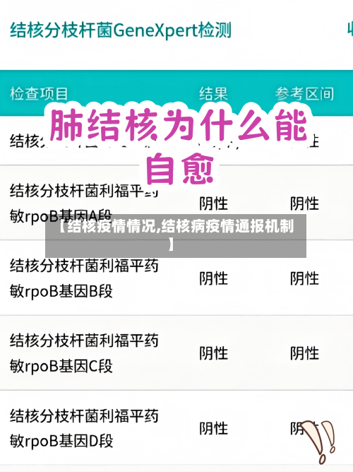 【结核疫情情况,结核病疫情通报机制】