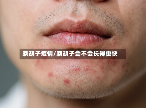剃胡子疫情/剃胡子会不会长得更快-第2张图片