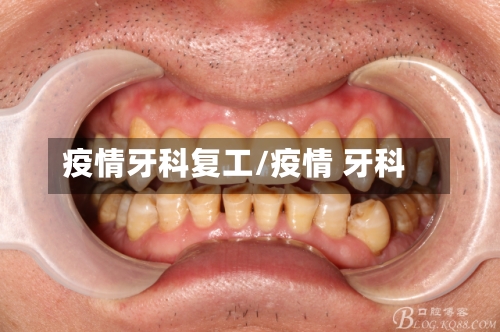 疫情牙科复工/疫情 牙科